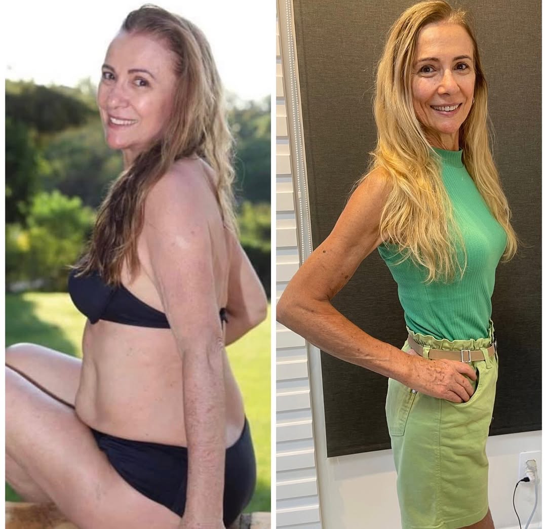 Antes e depois 4