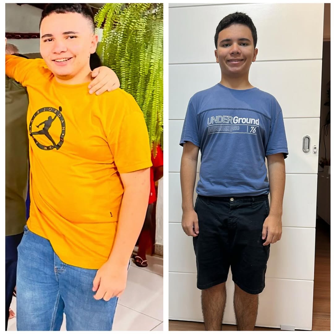 Antes e depois 6