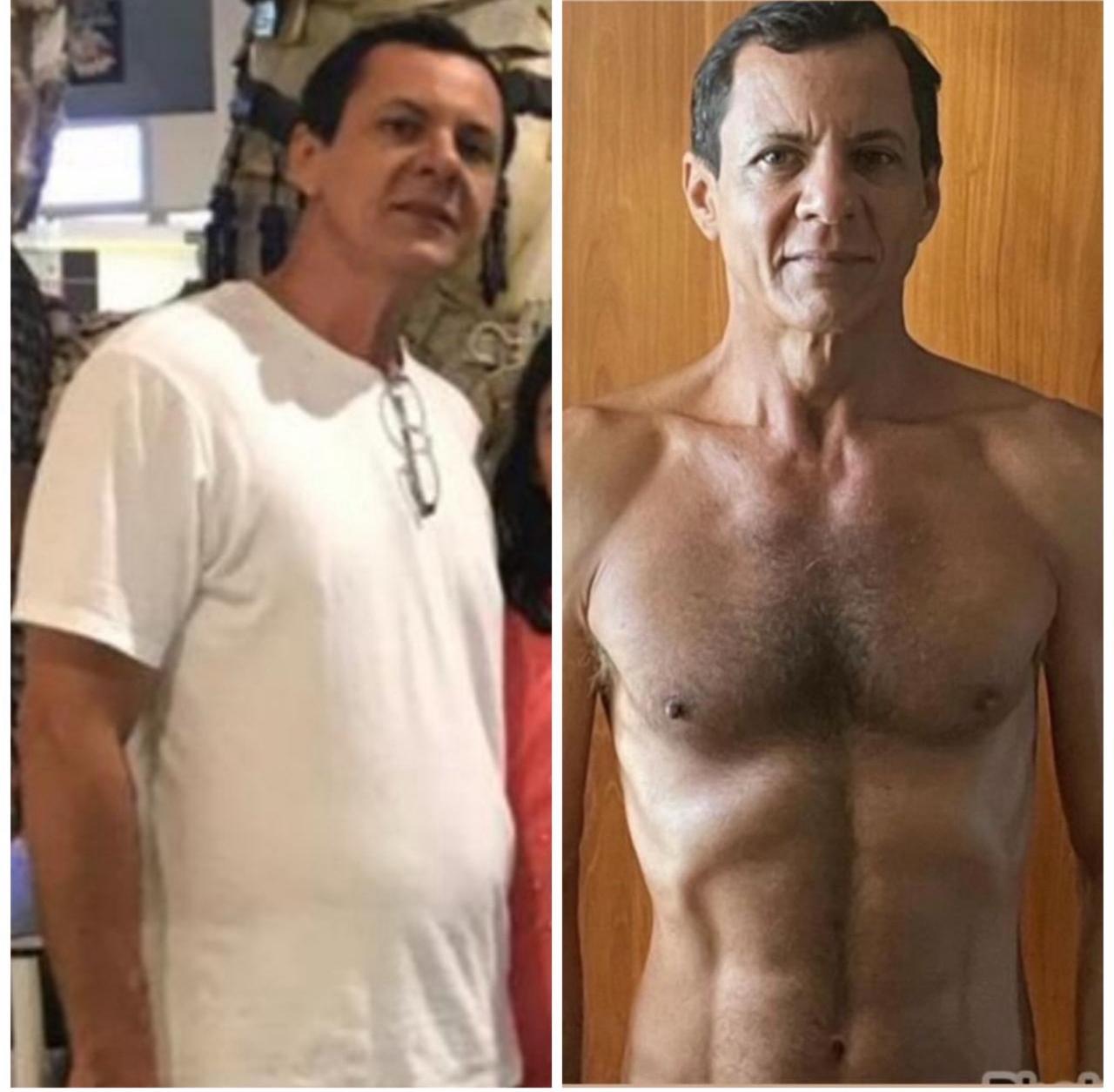 Antes e depois 7